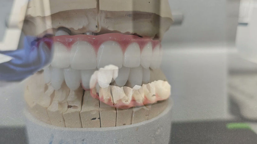 אמנון ופזית